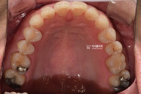 The Orthodontic Treatment Process & Why Precise Diagnosis Matters